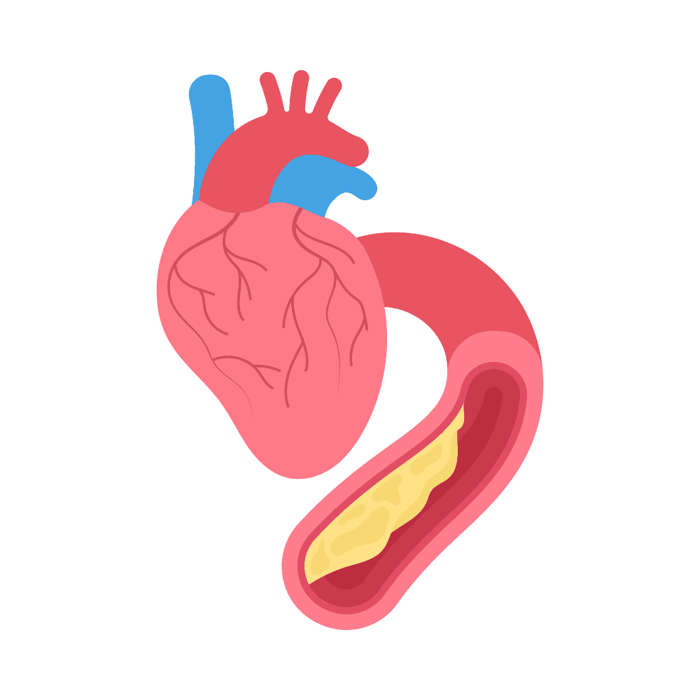Cardiovascular Disease