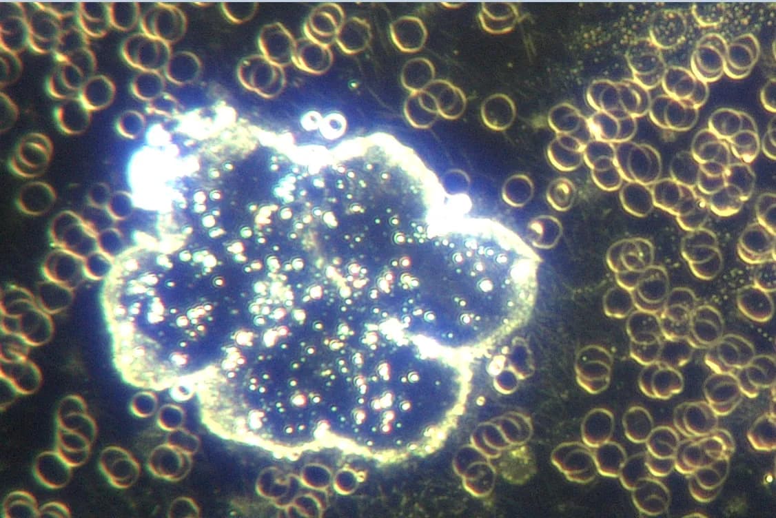 Live Blood Analysis Sample 2