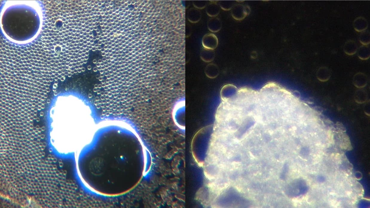 Live Blood Analysis Sample 1