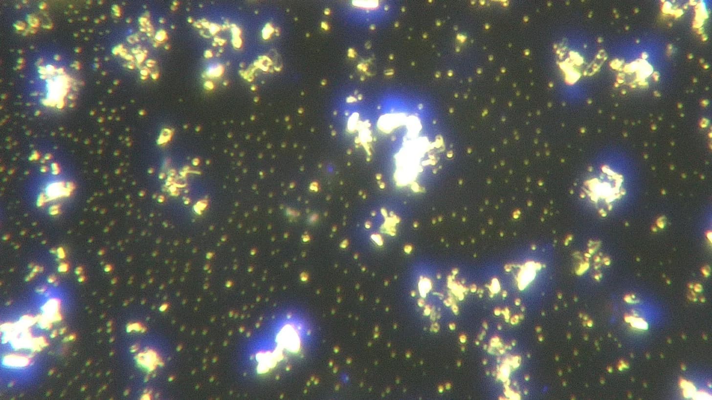 Live Blood Analysis Sample 2